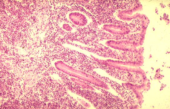 Microscopisch prepapraat.jpg (74016 bytes)